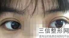 南昌做激光手术去哪家医院好，南昌哪个医院做眼睛激光比较好_1