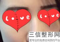 男生做个鼻子大概多少钱啊，男孩子整鼻子大概要花多少钱