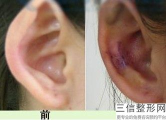 青岛治疗耳鸣比较好的医院，青岛治疗耳鼻喉医院哪家良好