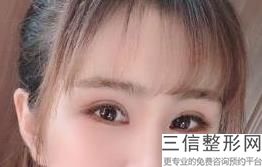 深圳割双眼皮良好的医院，深圳哪家医院割双眼皮效果好