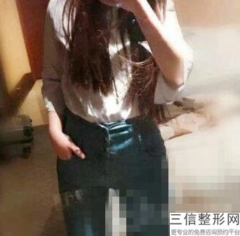 瘦腹部比较有效的方法，瘦腹部的方法
