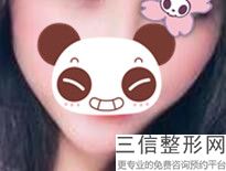 兔唇哪里医院比较好,兔唇现在都是免费治疗吗