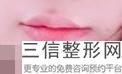 兔唇能整形吗，成人兔唇整形哪个医院良好