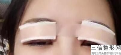 温州眼视光医院激光手术良好的医生，温州做激光手术哪家医院好