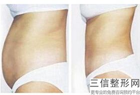 怎么样才能瘦小腿肌肉，怎样可以快速瘦大腿和小腿上的肉