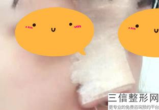 2022年北京3D无痕隆鼻整形医院前三名！北京凯润婷医疗美容医院都是私立机构入围_附价格费用参考