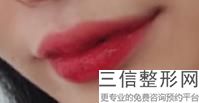 2022年北京M唇美容整形医院排名！北京王磊医疗美容诊所公立私立对比汇总