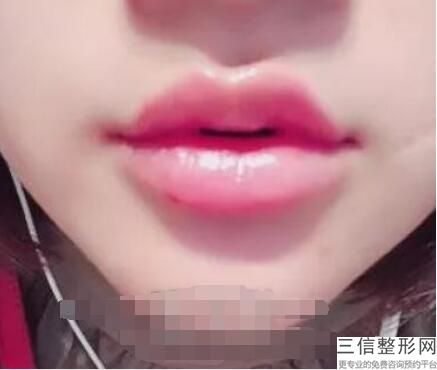 2022年北京M唇手术整容医院前三位!北京雍禾美度门诊部名满天下