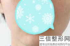 2022年北京爱贝芙丰唇医院怎么选择？北京澳保加医疗美容诊所医美公立私立汇总