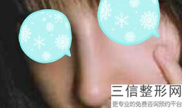 2022年北京爱贝芙注射隆鼻术整形医院三大排名！北京当代医院口碑入选！并附价格标准