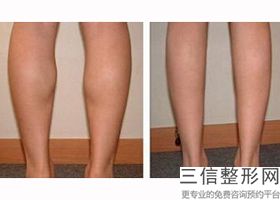 2022年北京按摩推拿整形医院选择？北京军区总医院皮肤激光整形美容排行榜前五强权威汇总盘点！