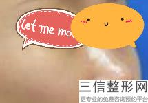 2022年北京鼻尖扁平整形整形医院哪家好？北京欧华国际医疗美容医院好又不贵的公立私立医院都有盘点