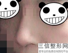 2022年北京鼻尖塑形美容医院前三！北京臻瑞汇美医疗美容医院口碑良好