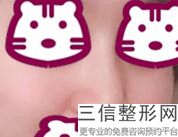 2022年北京鼻缺损修复再造整容医院前三名！北京印正山医疗美容诊所分析哪个效果更好