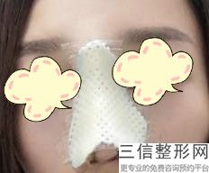 2022年北京鼻头缩小整形医院！北京侯涛医疗美容诊所等上榜！附价格表！