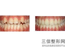 2022年北京鼻修复整形美容医院排名！北京维尔口腔（万达分院）等全国连锁入围
