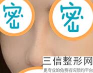 2022年北京鼻再造修复整形医院三大排名！北京壹加壹医疗美容门诊部价格及案例在线免费查询