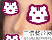 2022年北京鼻综合整形美容院榜单！北京凯尔医院排名靠前