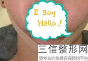 2022年北京玻尿酸丰唇整形医院榜单前三！北京京韩医疗美容诊所等荣誉上榜！价格收费可查！