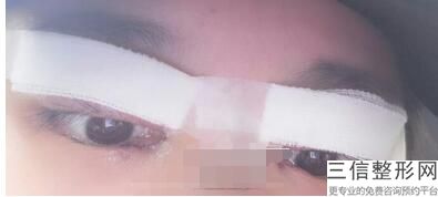 2022年北京玻尿酸去黑眼圈整形医院哪里有?北京俊泰美好医疗美容均有公立整形上榜