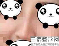 2022年北京玻尿酸注射隆鼻整形医院榜单！北京京美会医疗美容诊所收集了排名靠前的医院名单及价格费用请对比