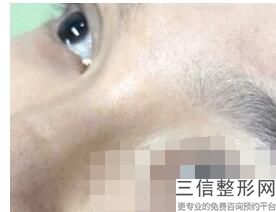 2022年北京超声去黑眼圈整形医院评价!北京壹加壹医疗美容门诊部都是私立机构入围_附价格费用参考