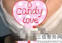 2022年北京唇珠唇峰整形医院排名!北京植信诺德医疗美容医院凭好口碑稳稳上前三强~