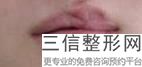 2022年北京唇珠整形医院排行榜！北京庆熙整形美容门诊部名闻遐迩