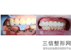 2022年北京达拉斯鼻整形医院有哪些？北京维尔口腔（宋家庄分院）价格及案例在线免费查询