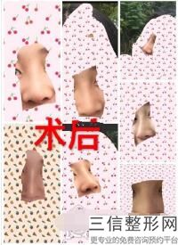2022年北京达拉斯鼻整形整形整容医院榜单！北京百达丽医疗美容门诊部看排名榜中公私立医院相互比拼！