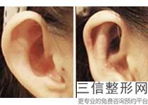 2022年北京大耳整容医院排名！北京新星靓医疗美容医院蒸蒸日上