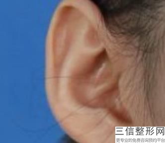 2022年北京耳垂整形医院!解放军总装备部后勤部亚运村门诊部私立医美3强优质口碑医院推荐
