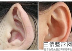 2022年北京耳软骨延长鼻小柱整形医院选择？北京美漾整形外科门诊部金榜题名