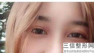 2022年北京丰眉弓整容整形医院排行榜！北京市海淀医院-激光整形美容科等领衔三甲