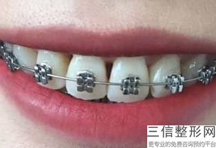 2022年北京丰面颊整形医院榜单!北京维尔口腔(小庄分院)位列前三