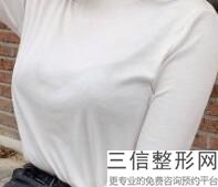 2022年北京复合式隆胸整形医院排名前三!北京聚美欧华医疗美容医院稳居口碑前三