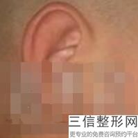 2022年上海菜花耳美容整形排行榜！上海长征医院大名鼎鼎