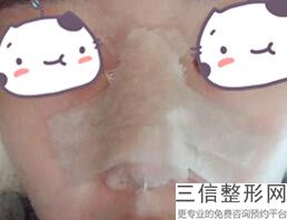 2022年上海侧鼻翼倾斜矫正整容整形医院排行榜！上海市黄浦区中心医院医美3强口碑技术点评！