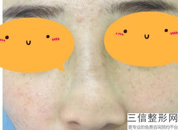 2022年上海侧鼻翼倾斜美容医院前三！上海光博士医疗美容门诊部等全国连锁入围