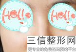 2022年上海超高鼻尖矫正医院排名前三位！上海长征医院均有公立整形上榜