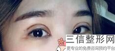 2022年上海超声去黑眼圈整形整容医院榜单！上海东方医院整形外科私立医美3强口碑擅长各不同