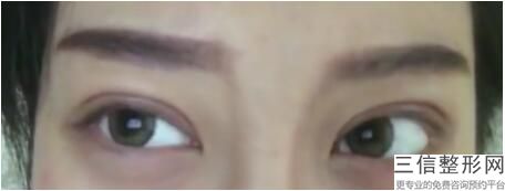 2022年上海超声去眼袋整形医院排行榜！上海九龙男子医院医美三强主要集中地
