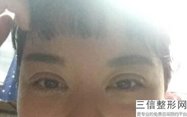 2022年上海抽脂去眼袋医院排名前三位!上海闵行中医医院等凭实力拔得头筹!