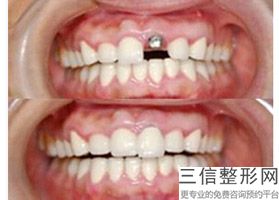 2022年上海垂乳上提术整形美容医院排名！上海恒愿口腔门诊部费用价格预览