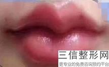2022年上海唇部畸形矫正整形美容院榜单！上海市黄浦区中心医院是你没看过的版本