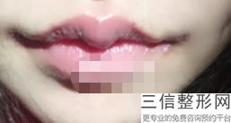 2022年上海唇颊部缺损修复术整形医院选择?上海沃德医疗中心私立医美3强优质口碑医院推荐