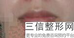 2022年上海唇毛整形医院哪家好?上海万众医院口碑技术点评_附价格一览表
