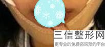 2022年上海唇毛整形医院排行榜！上海赛美瑞医疗美容门诊部排行榜前四私立领衔!
