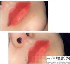 2022年上海唇珠整形医院三大排名！上海佳富美医疗美容门诊部公立对比全国私立连锁