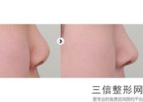 2022年上海达拉斯全鼻整形整形医院排行榜！上海光博士医疗美容门诊部领衔~公立私立口碑盘点